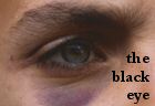 The Black Eye